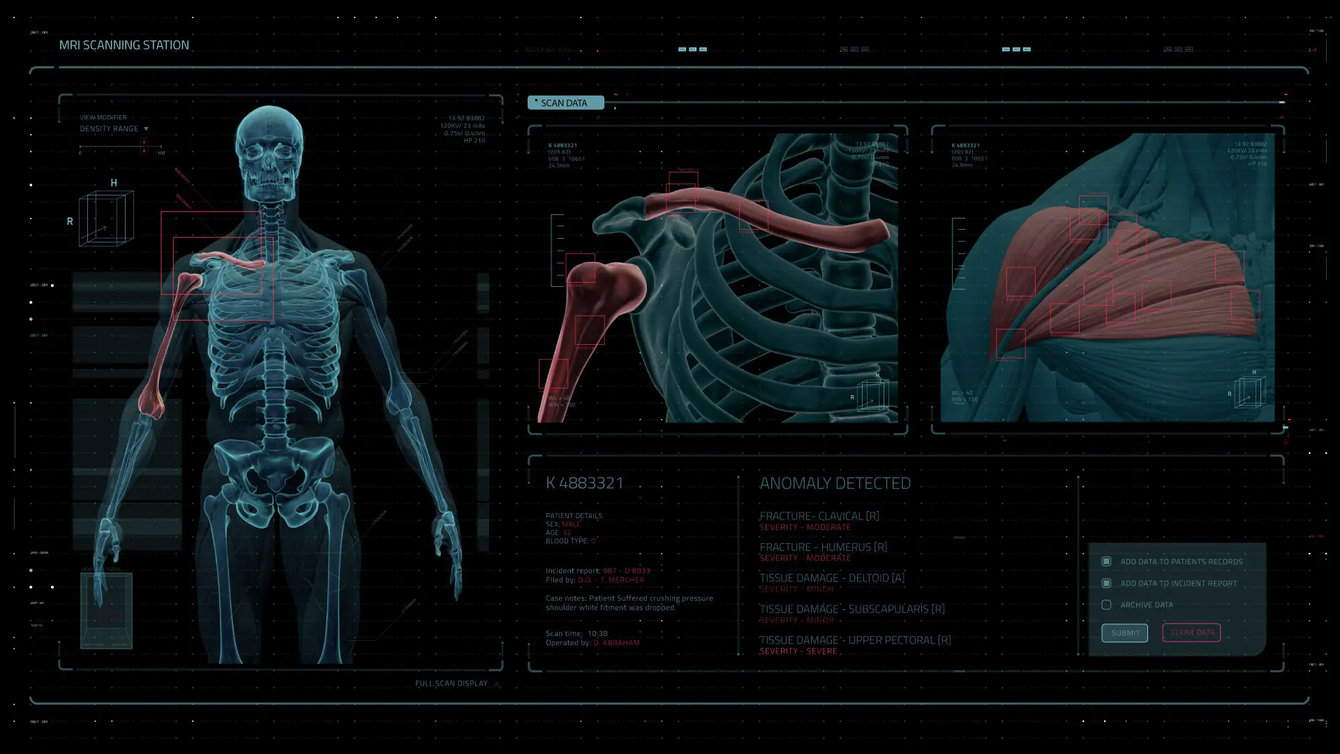 MediScreen-MRI-revision-v.1.2 MediScreen-MRI-revision-v.1.2