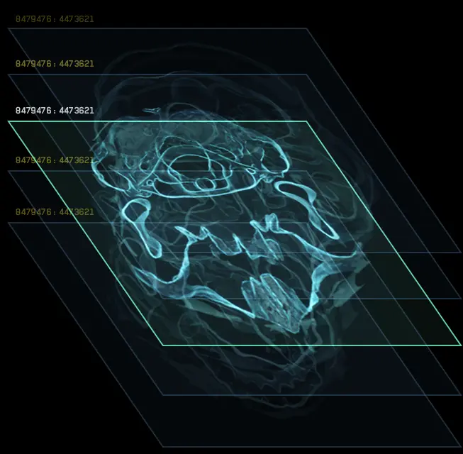 fake-MRI-skull-isolated-composite-exploded-tweak